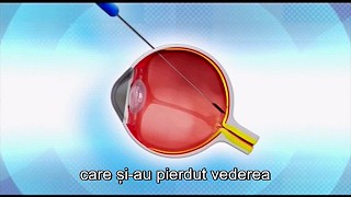 Israel, natiune binecuvantata 11 - Solutii pentru orbire